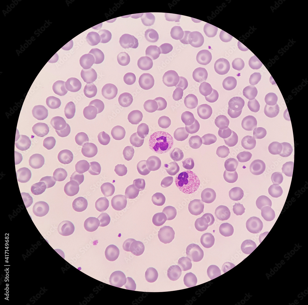 Under microscopic of elephant blood film showed red blood cell, platelet, heterophil, lymphocyte, monocyte and eosinophil. Blood morphology of Elephant. Under microscopic of elephant blood film showed red blood cell, platelet, heterophil, lymphocyte, monocyte and eosinophil. Blood morphology of Elephant.