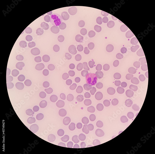 Under microscopic of elephant blood film showed red blood cell, platelet, heterophil, lymphocyte, monocyte and eosinophil. Blood morphology of Elephant.