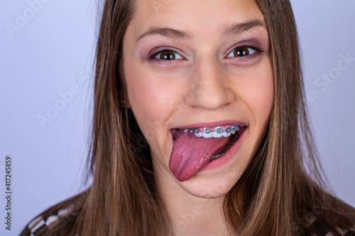 Teenager with smile shows white teeth with braces. white background.