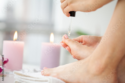 Applying medicated oil to the toenail to strengthen the nail plate and age the nail fungus.