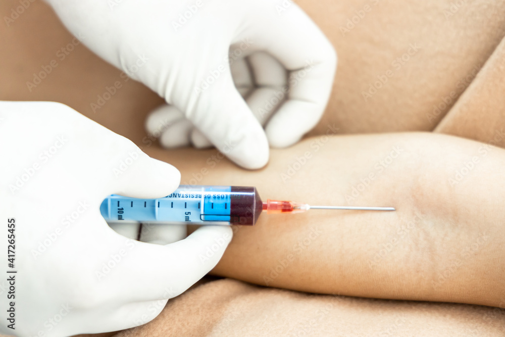 Hand of nurse, doctor or medical technologist in white gloves with syringe taking blood sample from a patient in the hospital, Doctor drawing blood sample from arm for blood test. Hand of nurse, doctor or medical technologist in white gloves with syringe taking blood sample from a patient in the hospital, Doctor drawing blood sample from arm for blood test.