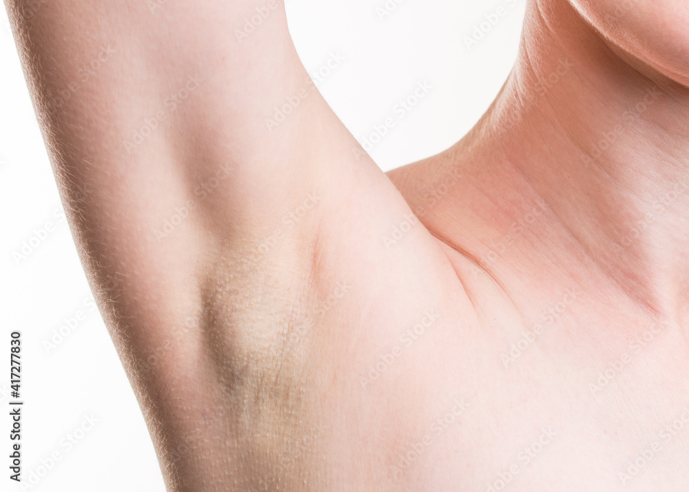 Woman armpit after shaving hair. Skinny girl with hair depilation on white background. Cosmetic procedures. Beauty salon. Macro close-up skin.