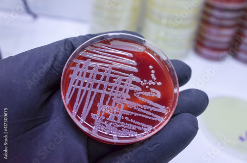 growth of bacteria on blood agar photo