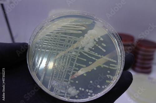 bacterial growth on culture media in petri dish  photo