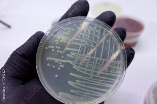 bacterial growth on culture media in petri dish  photo