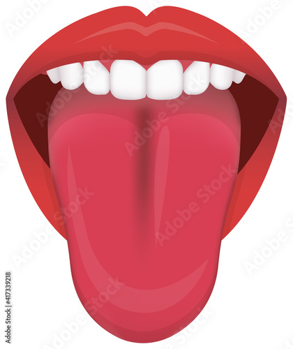 Tongue’s health sign vector illustration ( Strawberry Tongue )