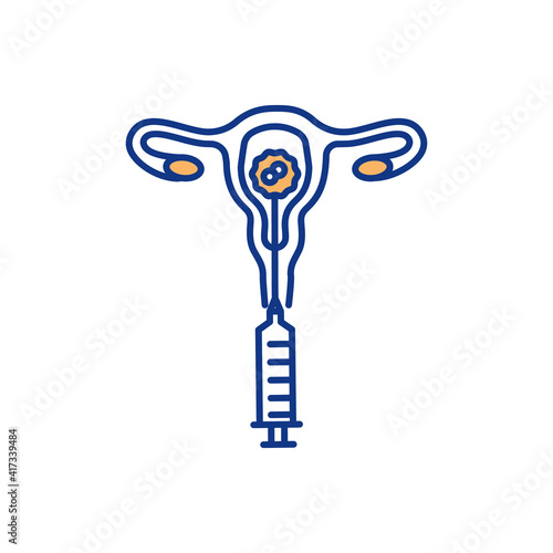 Artificial insemination RGB color icon. Vitro fertilization. Sperm injection. Artificial reproduction. Woman infertility treatment. Embryos transfer procedure. Isolated vector illustration