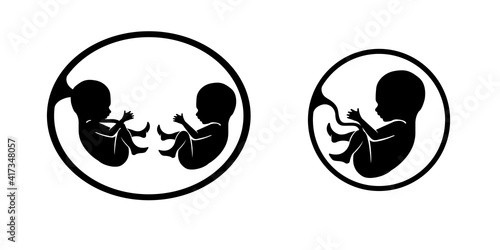Ultrasound scan of baby. Shot of scanning pregnant woman.