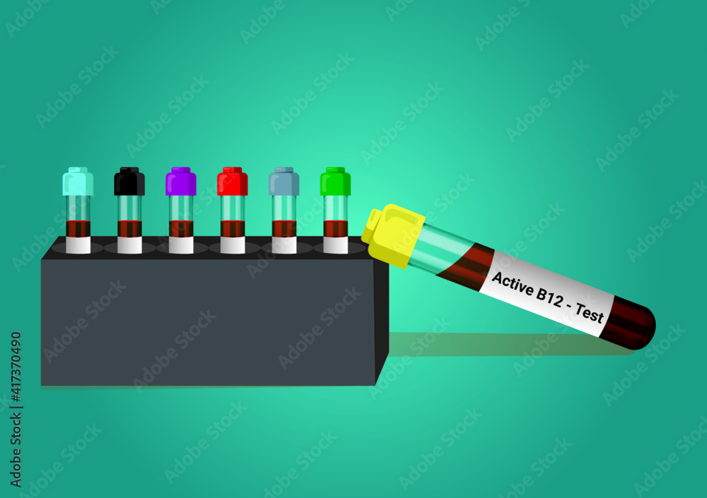 Blood Sample For Active Vitamin B12 Test. A Medical Testing Concept ...