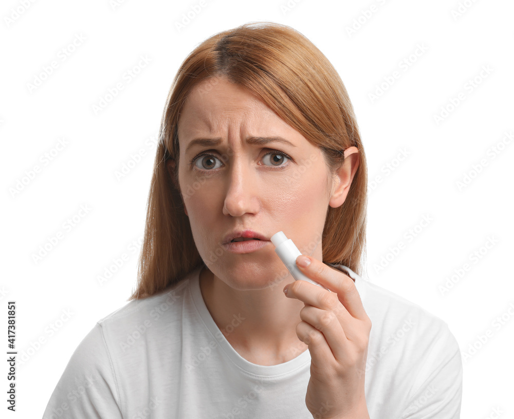 Upset woman with herpes applying lip balm against white background Upset woman with herpes applying lip balm against white background