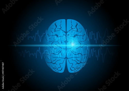 Illustration of focal seizure and human brain photo