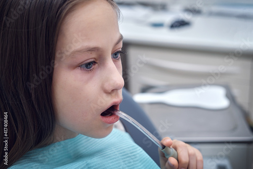 Fotografie A teenage girl sits in a chair at the dentist's doctor and holds a saliva ejector in her mouth