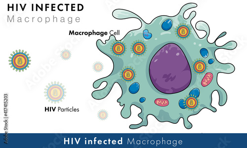 Macrophage phagocytic immune cell infected with human immune deficiency virus, HIV retro virus causes AIDS biomedical illustration. 