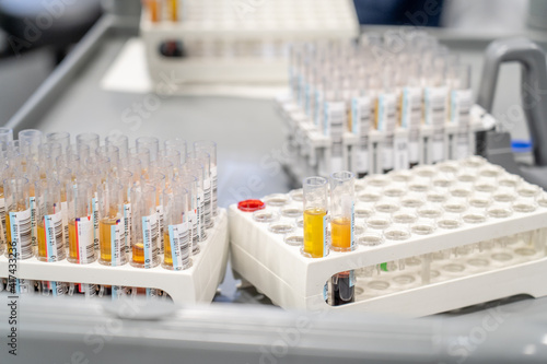 laboratory doing tests for vaccine blood collection and hematology analytics photo