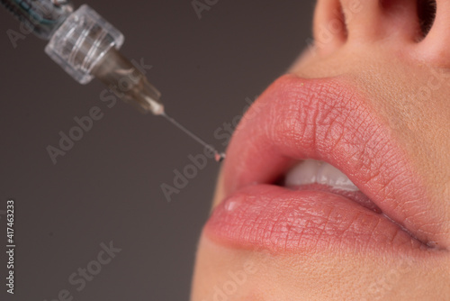 Closeup of lips augmentation. Syringe female mouth. Cosmetology Treatment. Hyaluronic acid injection. Age changes. photo