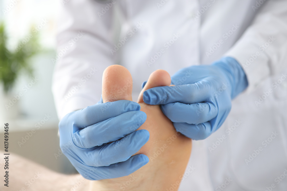 Gloved doctor examines patient's skin on leg between toes Gloved doctor examines patient's skin on leg between toes