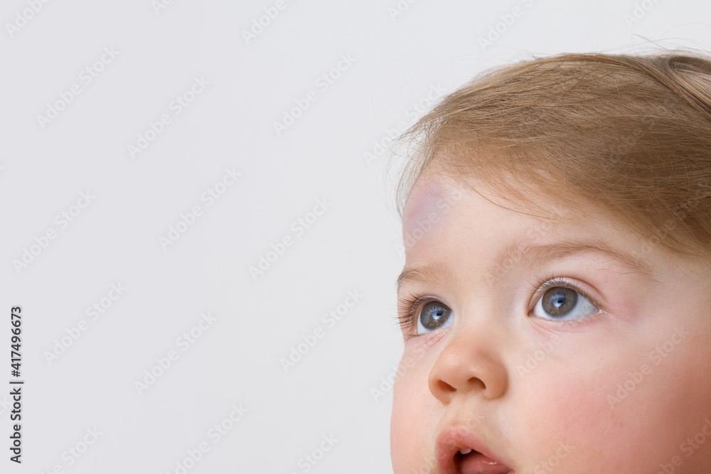 A large bump on the child's forehead. Baby bruises concept A large bump on the child's forehead. Baby bruises concept