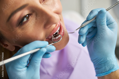 Dentist checking upper teeth with a dental mirror