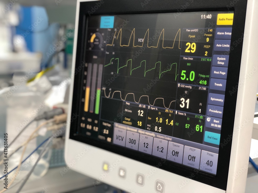 The medical ventilator monitoring screen in operating room. Stock Photo