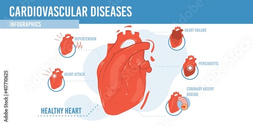 Vector flat cartoon infographic,healthy heart and list of diseases-human internal organs diagnostics,medical treatment and therapy concept