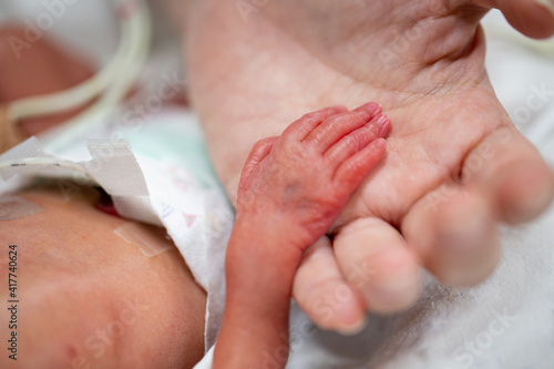 Newborn neonatal infant pulse oximeter premature photo