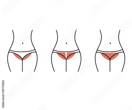 Bikini area depilation. Silhouette of a woman. Vector illustration.