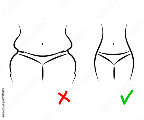 Weight loss. Linear silhouette of a woman. Thick and thin. Vector illustration.