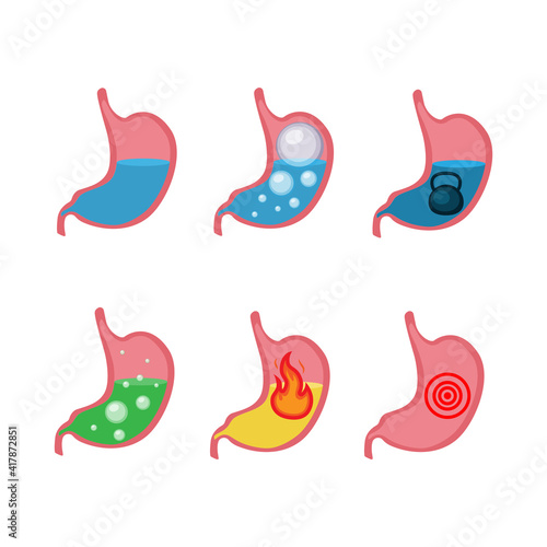 Heartburn and uclear symptoms vector illustration in a cartoon flat style photo