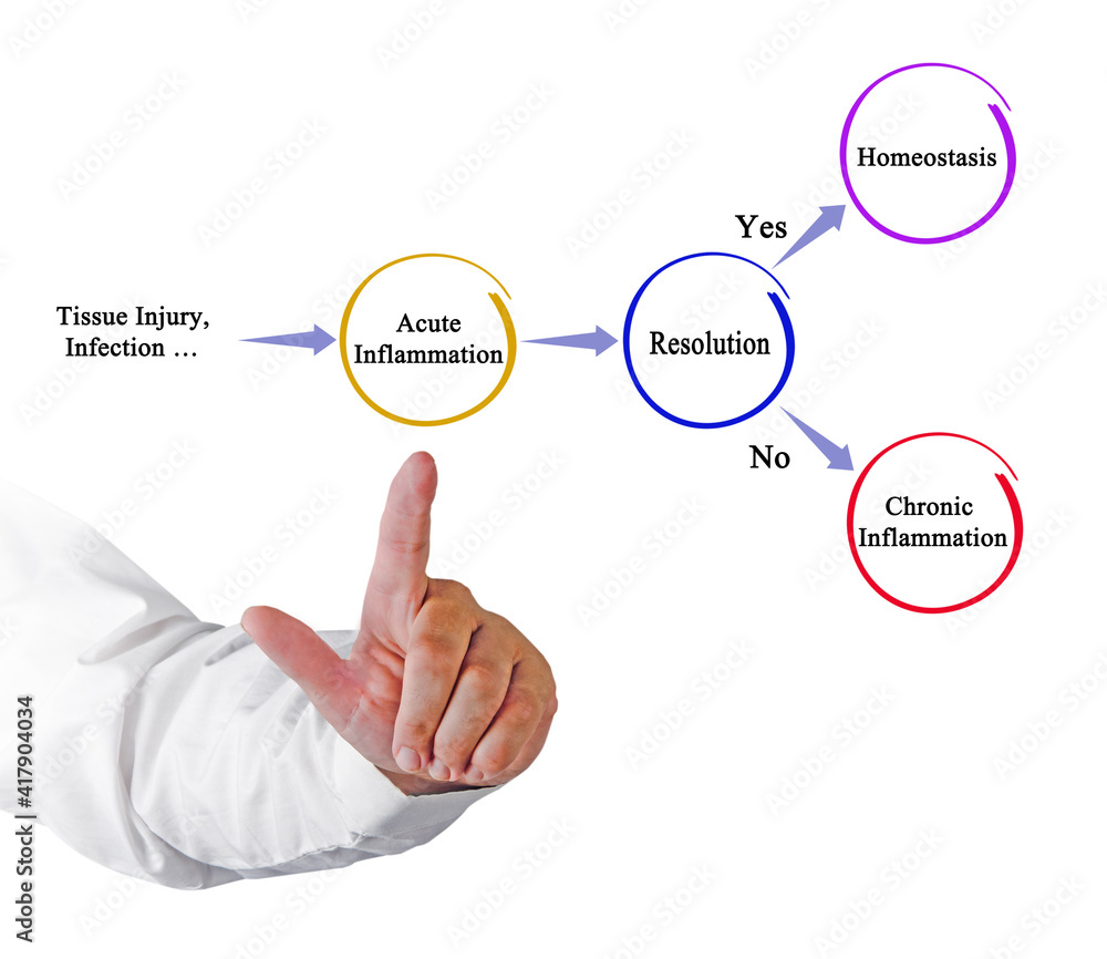 Two ways of resolution of acute inflamation Two ways of resolution of acute inflamation