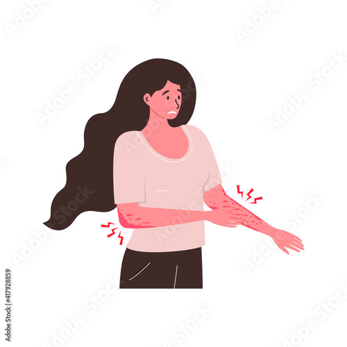 Flat vector illustration of an unhappy suffering woman scratching the skin on her hand. Various skin problems, such as allergies, psoriasis, itching, atopic dermatitis, eczema, dryness, redness.