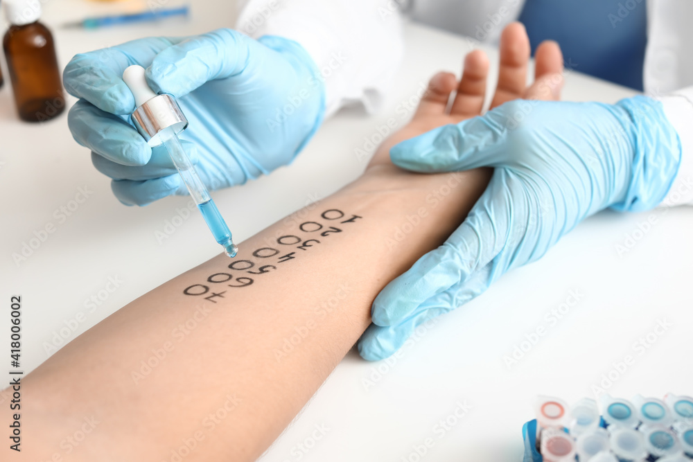 Young woman undergoing procedure of allergen skin tests in clinic