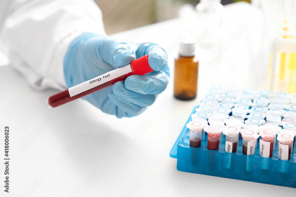 Doctor with allergy test in laboratory Doctor with allergy test in laboratory