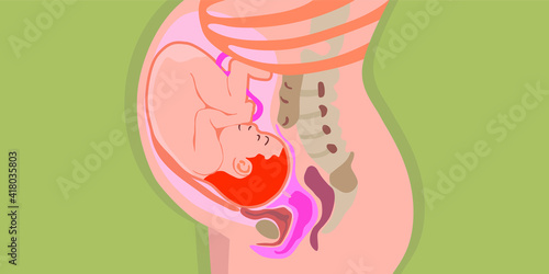 Vector flat stylish illustration of a pregnant woman and a baby in the womb. Medical poster. Development. Pregnancy from the inside. Umbilical cord. Embryo. Isolated. Carrying. Accoucheur, genecology