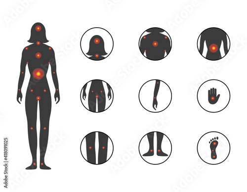 Point of female body pain. Injury icon set. Silhouette of a woman with different body pain. Vector