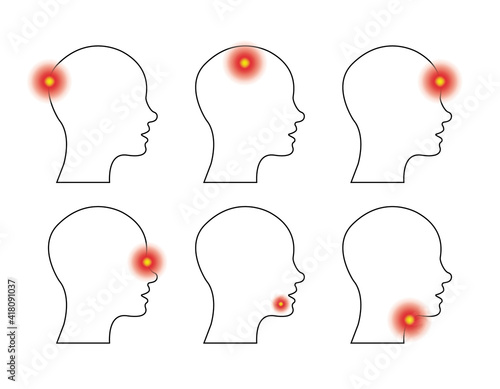 Type of headache and toothache, sore throat. Set of head profile with different pains. Side view. Vector