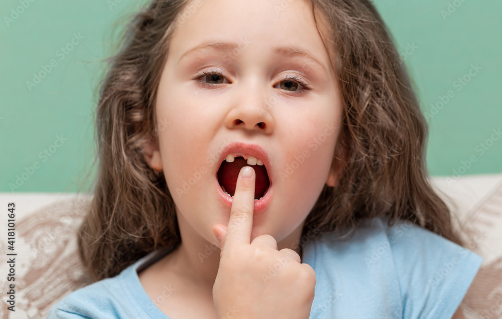 The little girl has no tooth. The child lost a baby tooth. The baby shows the place where the tooth fell out. High quality photos The little girl has no tooth. The child lost a baby tooth. The baby shows the place where the tooth fell out. High quality photos