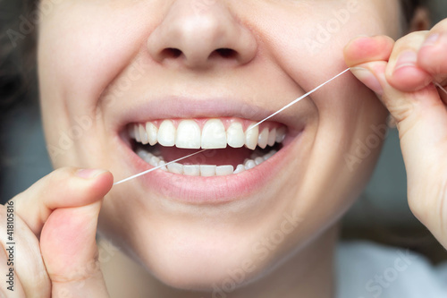 Close-up of female teeth. A Young beautiful woman flossing her teeth. Dental concept