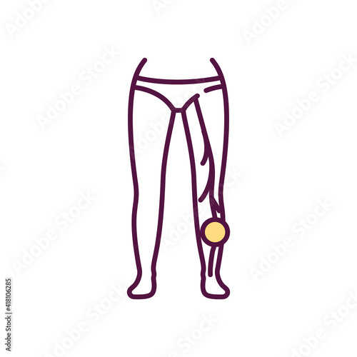 Blood clot in leg vein RGB color icon. Deep vein thrombosis. Pain, inflammation in affected area. Cramping sensation. Blood flow obstruction. Thrombus. Leg cramps. Isolated vector illustration