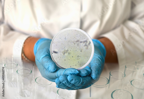 a girl in a medical gown and gloves holds a photo of Trichomonas from a microscope in a round frame photo