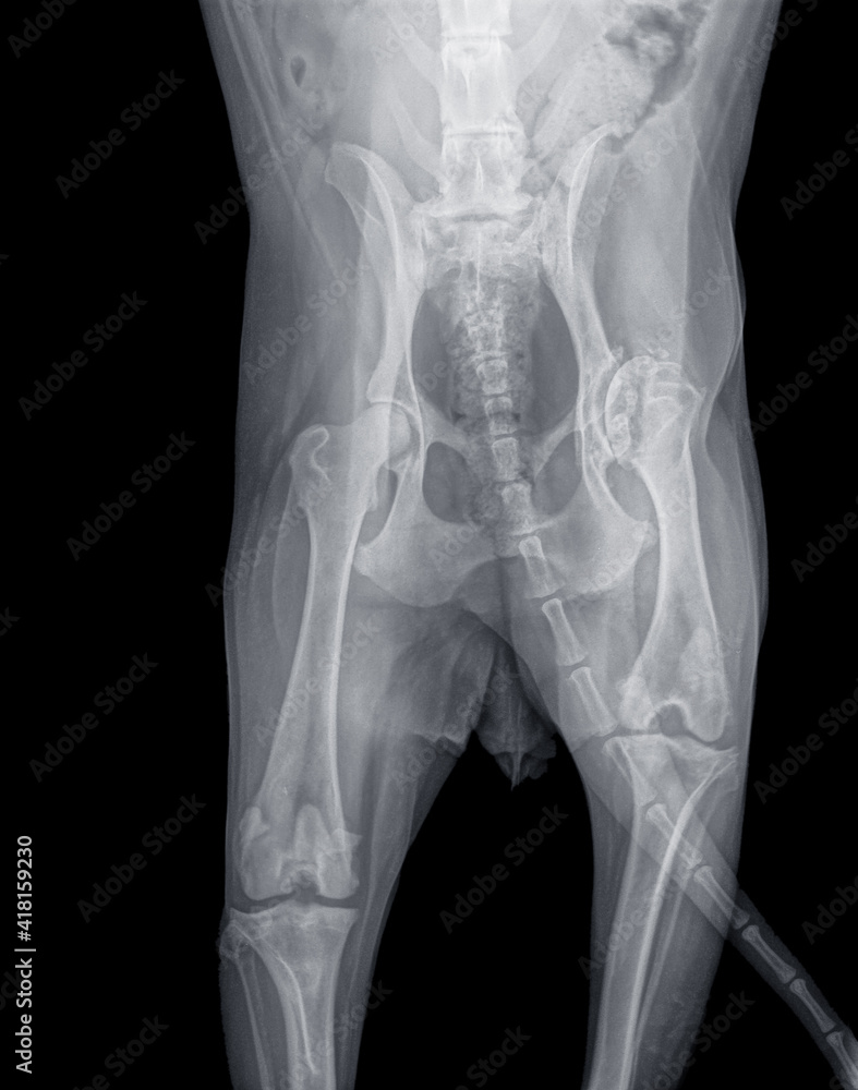 X-ray of a dog with severe hip dysplasia and osteoarthritis of the right hip and bone dissolution in the hip head. The right femur is also much shorter than the left one X-ray of a dog with severe hip dysplasia and osteoarthritis of the right hip and bone dissolution in the hip head. The right femur is also much shorter than the left one