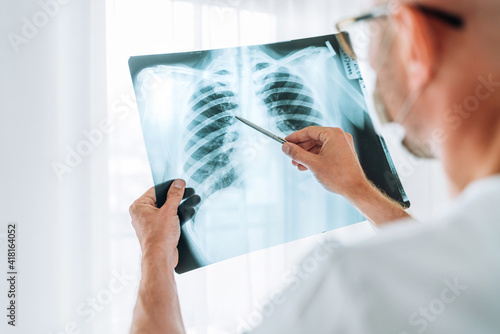 Male doctor examining the patient chest x-ray film lungs scan at radiology department in hospital.Covid-19 scan body xray test detection for covid worldwide virus epidemic spread concept. photo