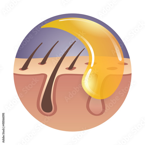 Sugaring - hair removal method using hot wax
