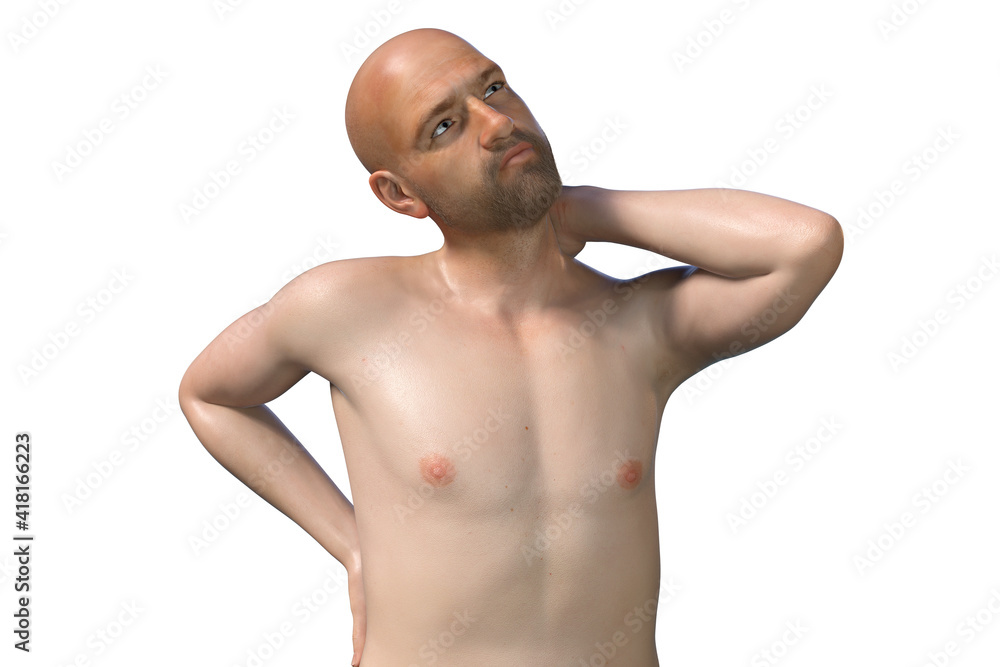 Fototapeta premium Neck pain, illustration