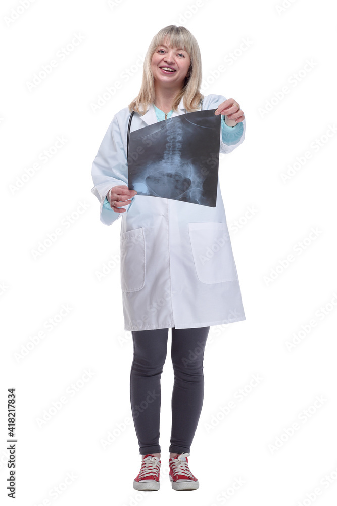 x-ray in the hands of a woman doctor . isolated on a white background. x-ray in the hands of a woman doctor . isolated on a white background.