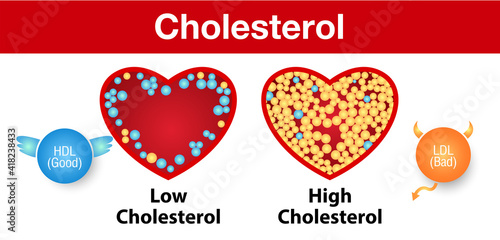 Cholesterol in artery, health risk , vector design.