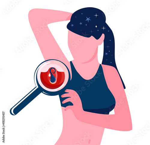 Ingrown hair problem after shaving the armpit with an electric epilator or razor with blade.Young woman in sportswear.Magnifier zooms inflammation.Clogged pores.No face.Vector illustration