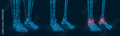 Pain, injury or inflammation of the ankle joint polygonal vector illustration. Low poly model of human feet.