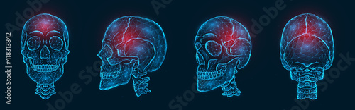 Pain, injury or inflammation of the skull bones polygonal vector illustration. Low poly model of a human skull
