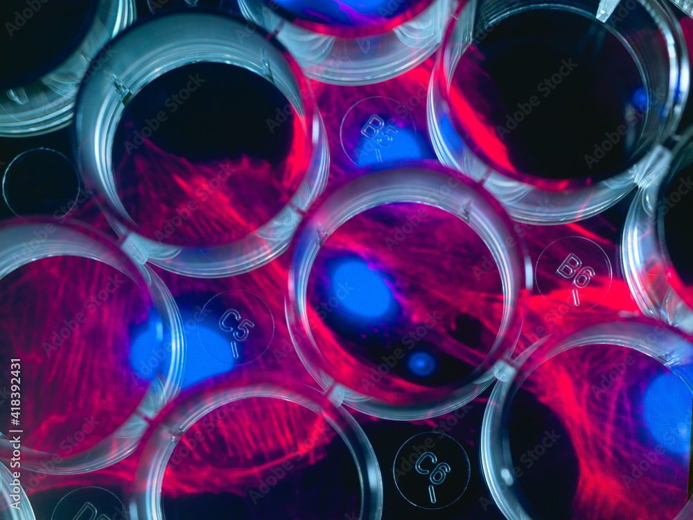 © Connect Images - Stem cell research, multi well plate with screen image of stem cells in the background