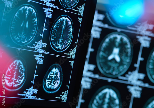 Brain scans of possible disease or damage in clinic